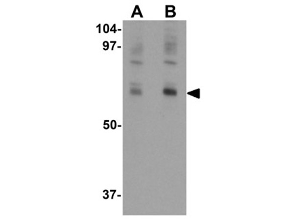 Western blot analysis of NUMB