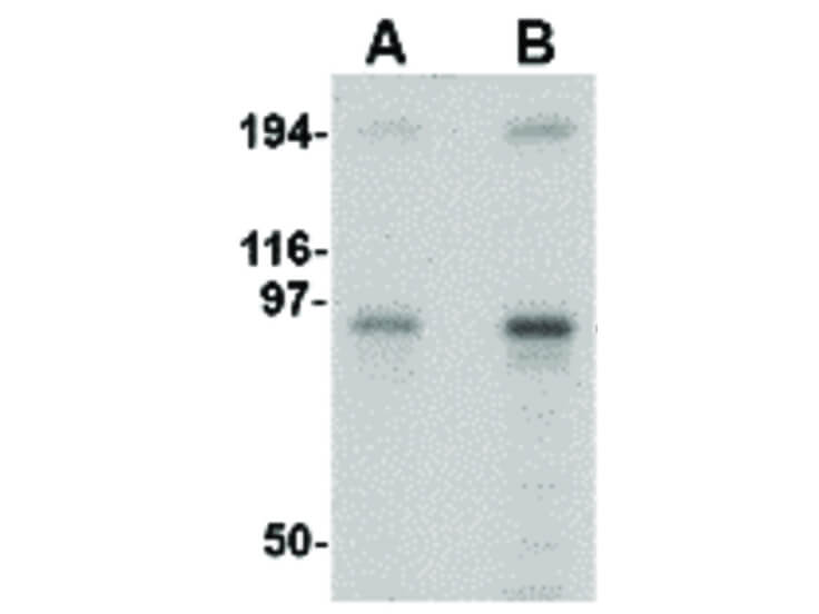 Western Blot of NUP107 Antibody