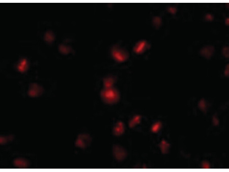 Immunofluorescence of NUP107 Antibody