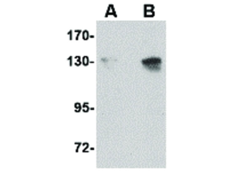 Western Blot of NUP155 Antibody