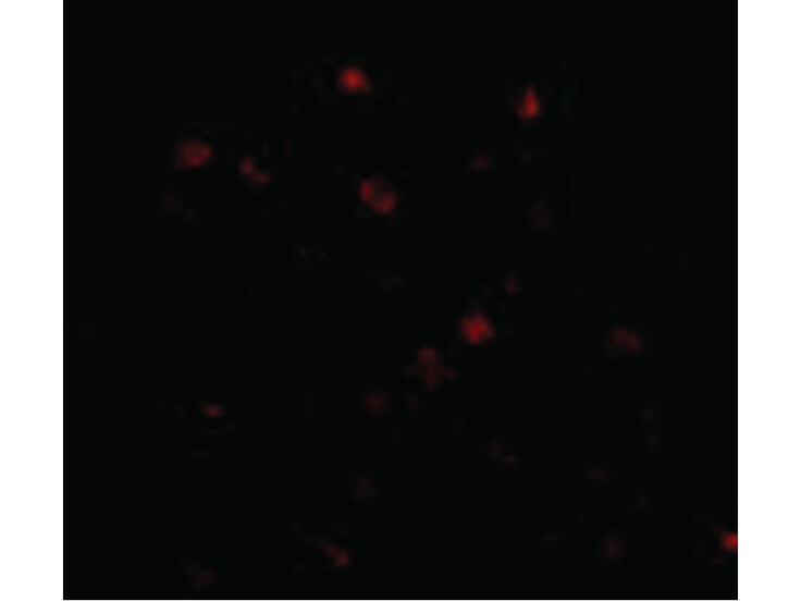 Immunofluorescence of NUP160 Antibody