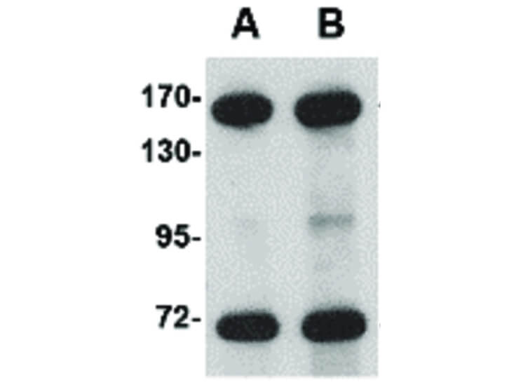 Western Blot of NUP160 Antibody