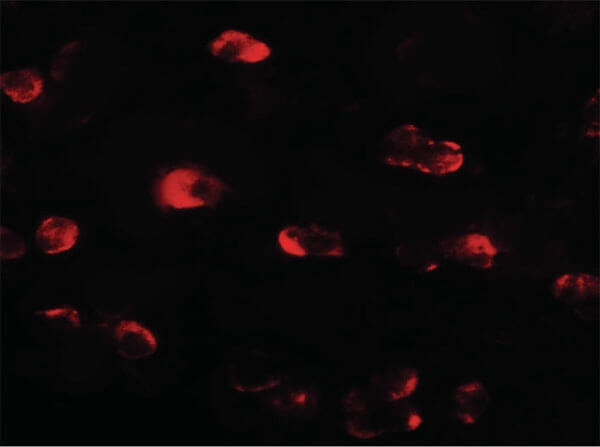 Immunofluorescence of OASL Antibody