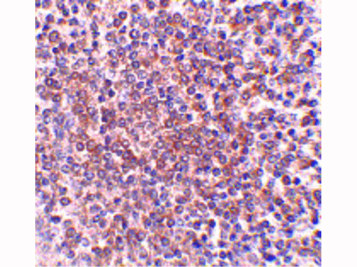 Immunohistochemistry of OCC-1 Antibody