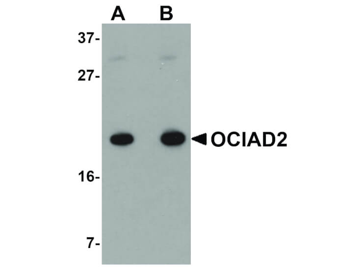 Western Blot of OCIAD2 Antibody