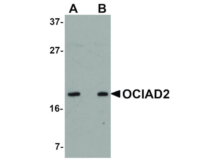 Western Blot of OCIAD2 Antibody