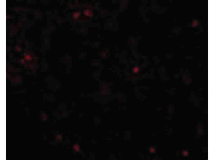 Immunofluorescence of OCLN Antibody
