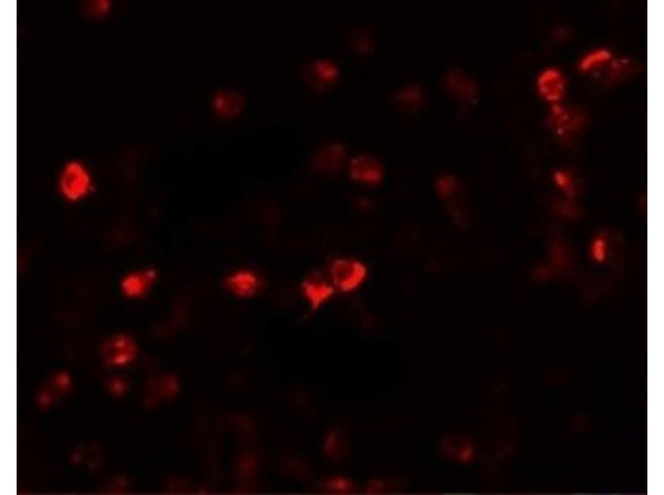 Immunofluorescence of OGFOD1