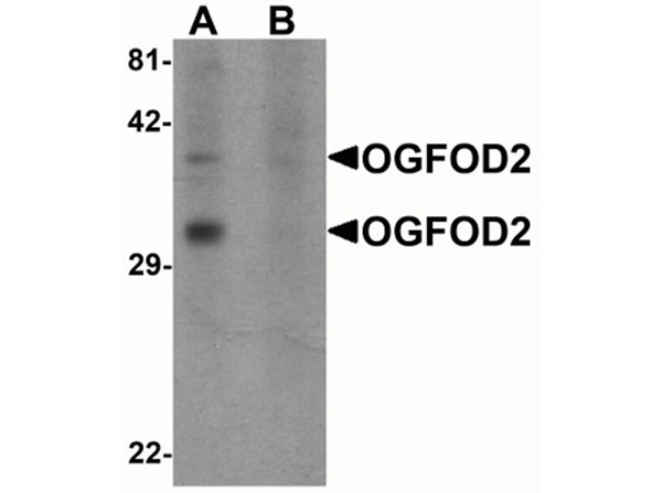 Western blot analysis of OGFOD2