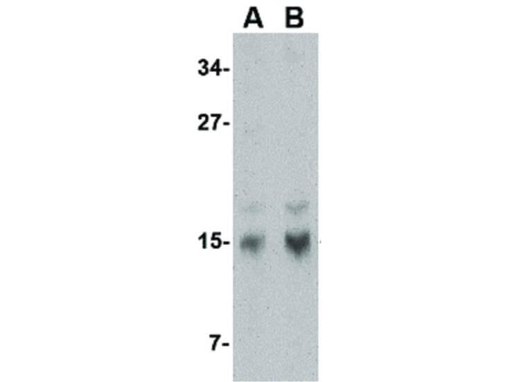 Western Blot of op18 Antibody