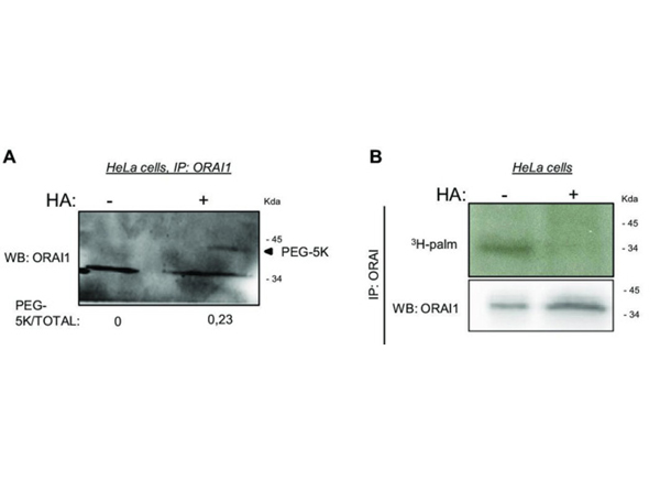 Western Blot using ORAI1