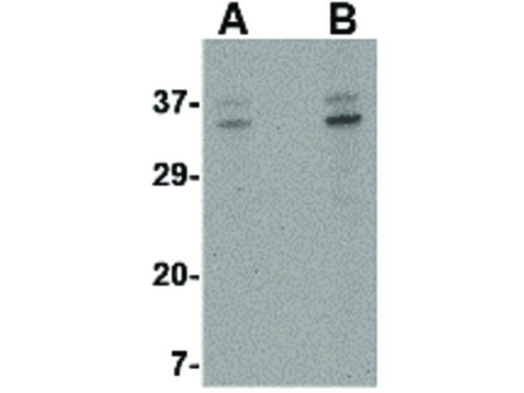 Western Blot of ORAI3 Antibody