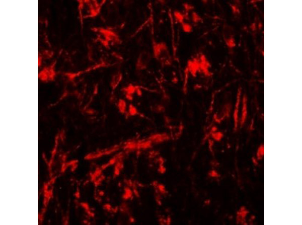 Immunofluorescence of ORMDL1.