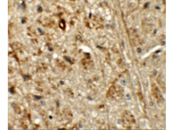 Immunohistochemistry of ORMDL1
