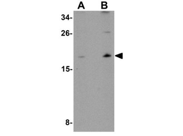 Western blot analysis of ORMDL1