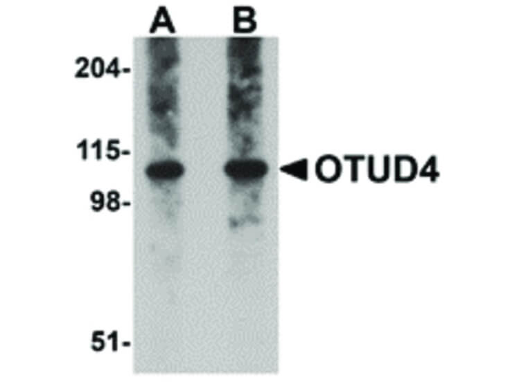 Western Blot of OTUD4 Antibody