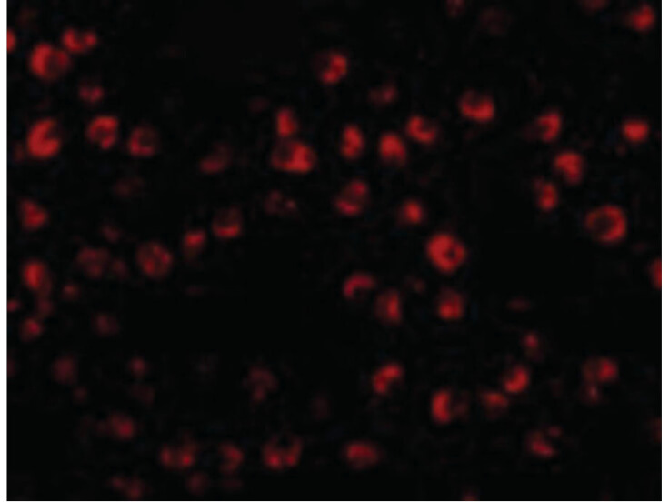 Immunofluorescence of OTUD4 Antibody