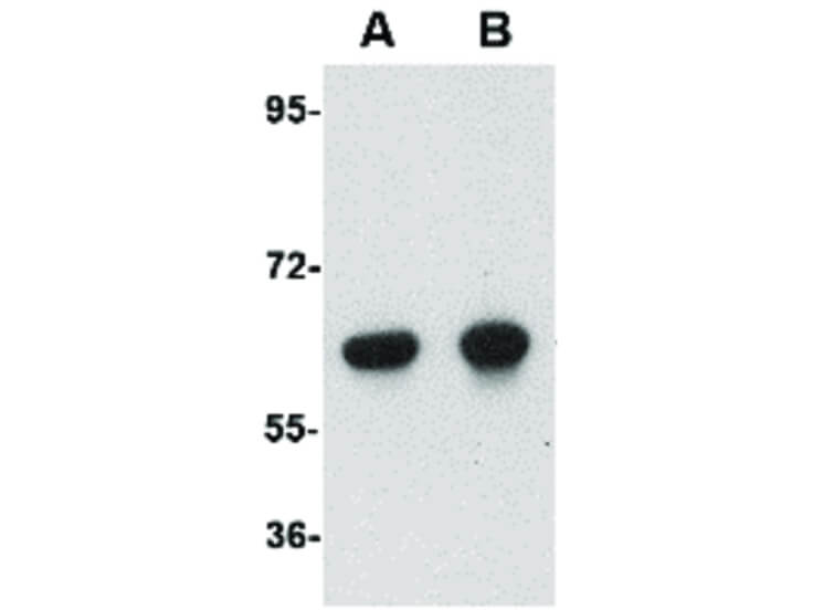 Western Blot of OTUD5 Antibody