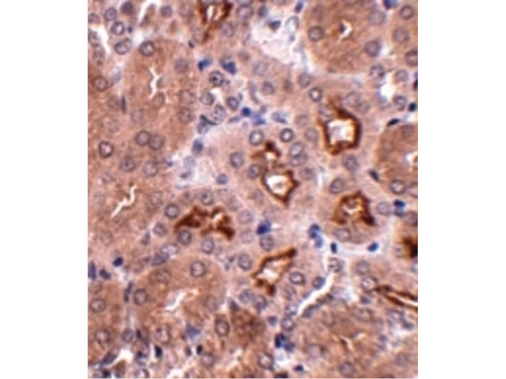 Immunohistochemistry of OTUD5 Antibody