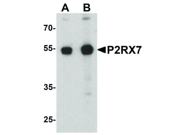 Western Blot of P2RX7 Antibody