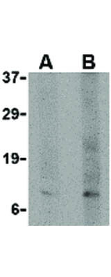 Western Blot of p53AIP1 Antibody