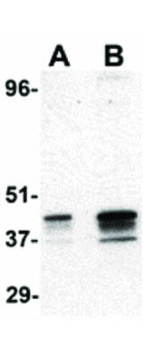 Western Blot of p53R2 Antibody