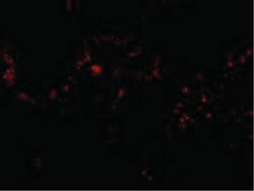 Immunofluorescence of p53R2 Antibody