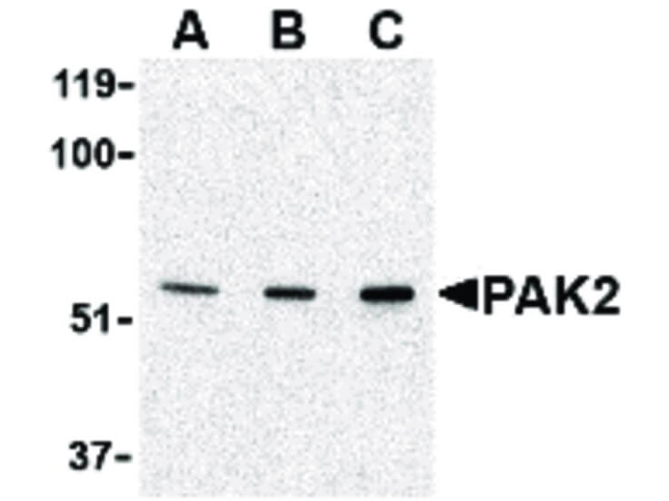 Western Blot of PAK2 Antibody