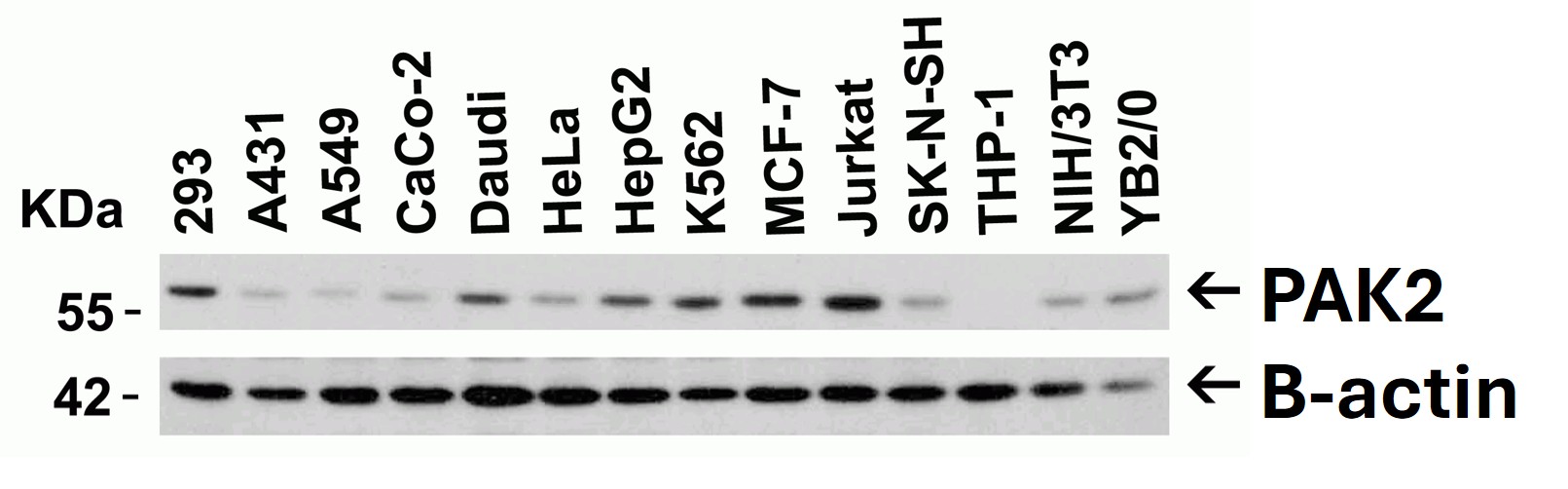Western Blot using PAK2