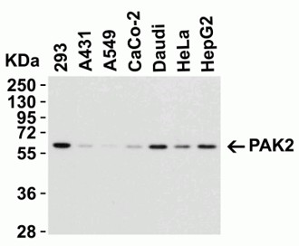 Western Blot using PAK2