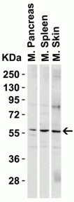 Western Blot using PAK2