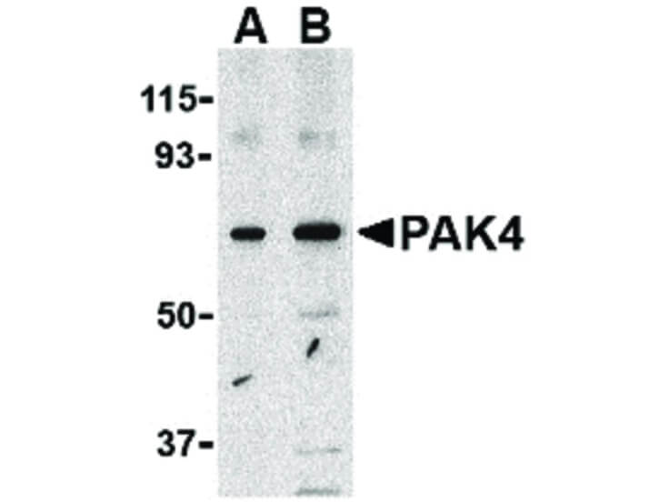 Western Blot of PAK4 Antibody