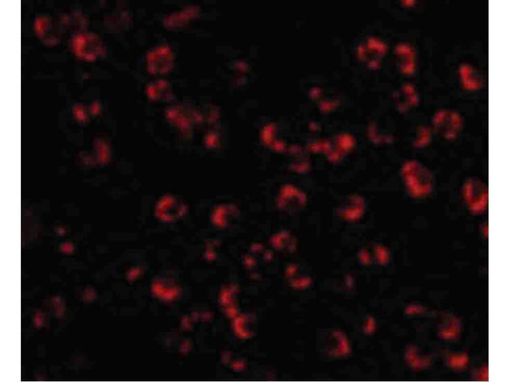 Immunofluorescence of PAK5 Antibody