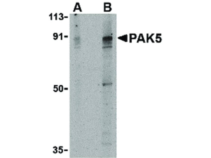 Western Blot of PAK5 Antibody