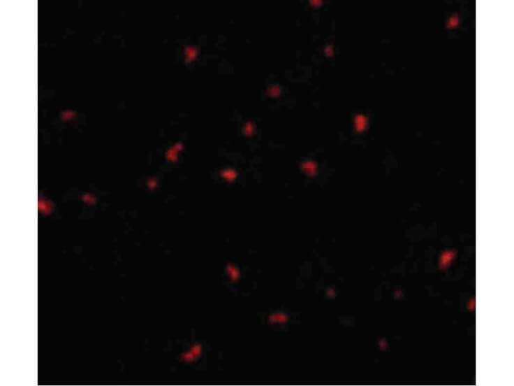 Immunofluorescence of PAK6 Antibody