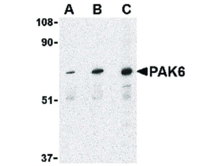 Western Blot of PAK6 Antibody