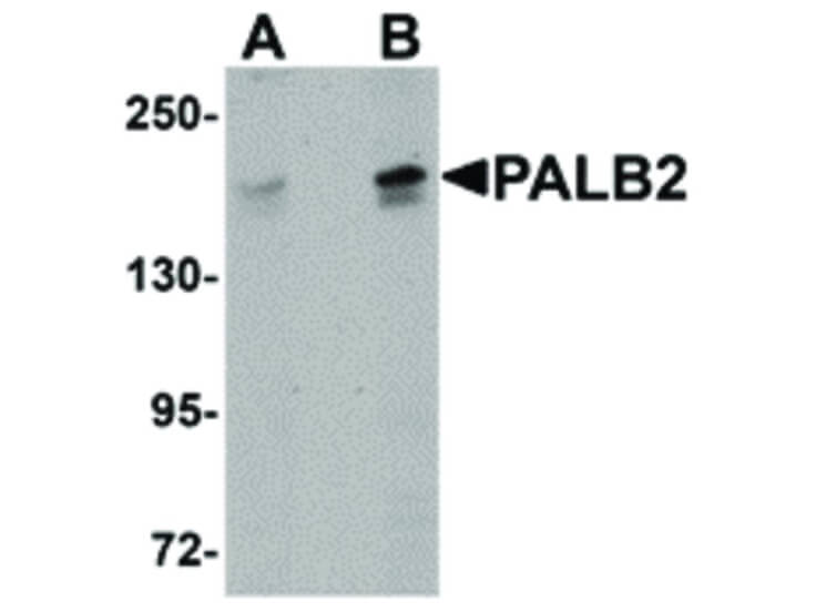 Western Blot of PALB2 Antibody