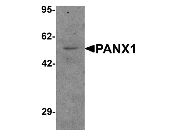 Western blot analysis of PANX1