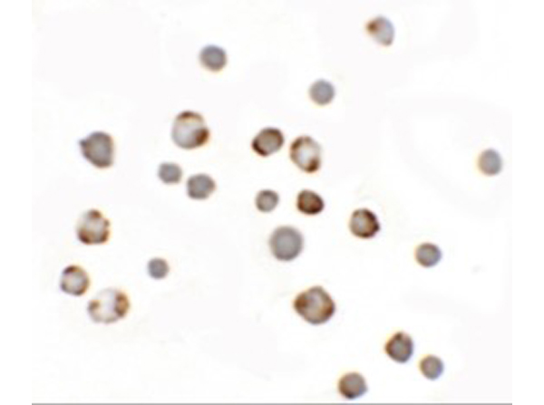 Immunocytochemistry of Paralemmin 3