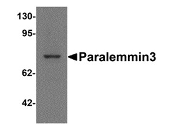 Western blot analysis of Paralemmin 3