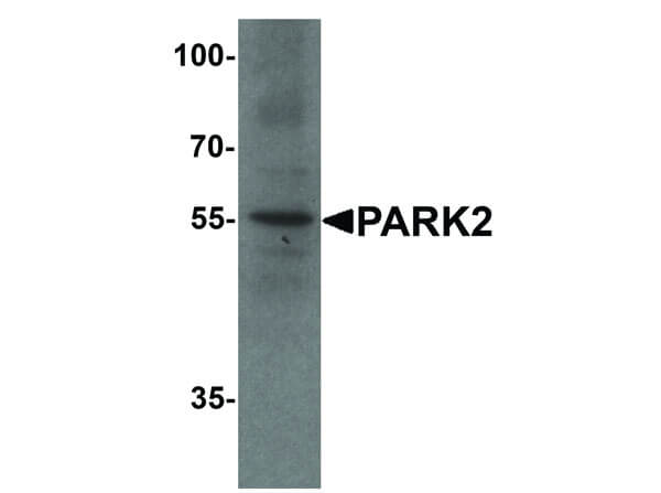 Western Blot of PARK2 Antibody