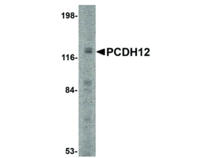 Western Blot of PCDH12 Antibody