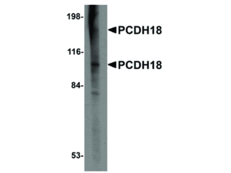 Western Blot of PCDH18 Antibody