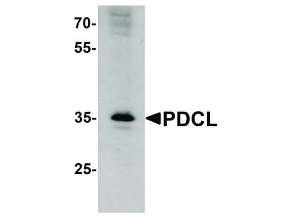 Western Blot of PDCL Antibody