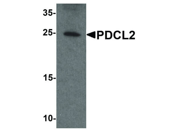 Western Blot of PDCL2 Antibody