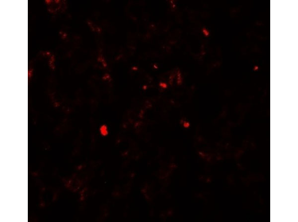Immunofluorescence of PDGF-B