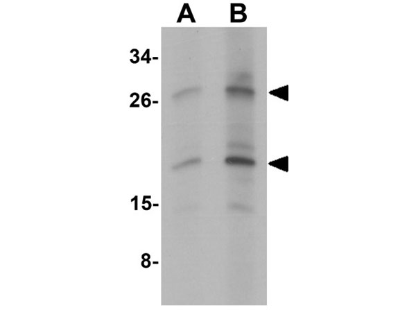 Western blot analysis of PDGF-B