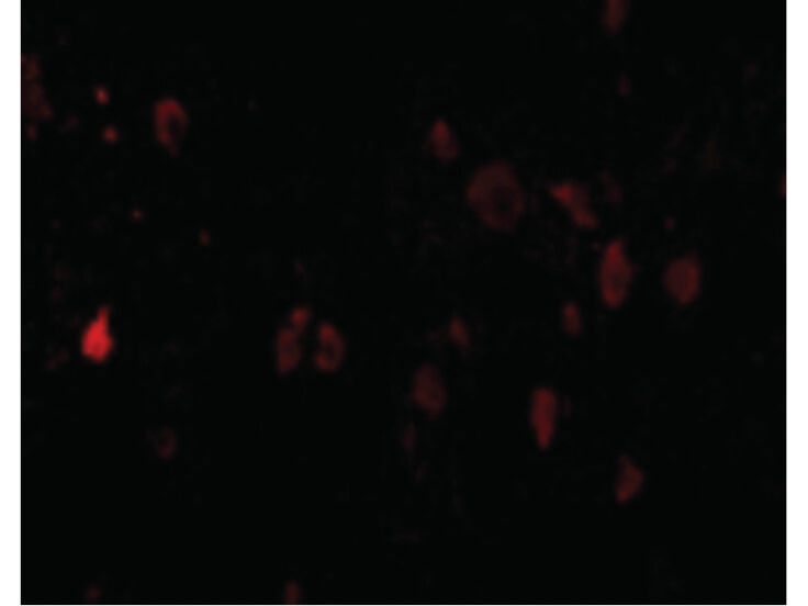 Immunofluorescence of PDL-2 Antibody