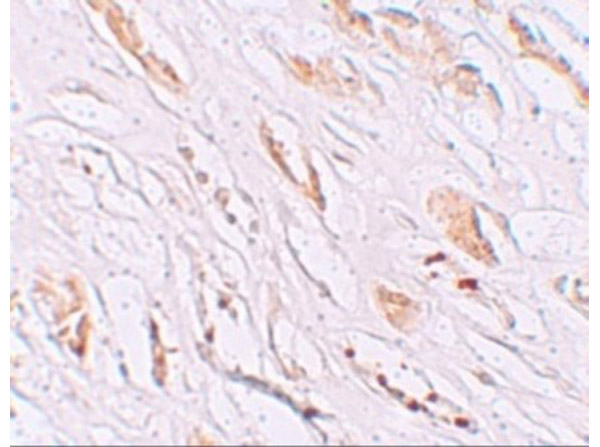 Immunohistochemistry of PEAR1