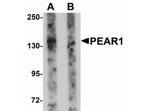 Western blot of PEAR1